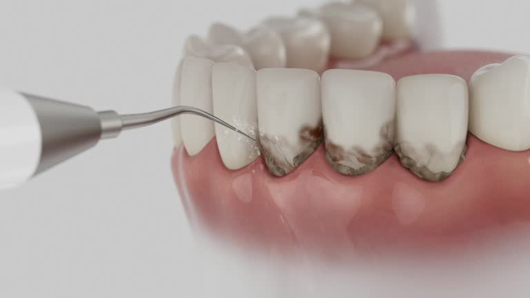 Reliable Dental contractor in Canterwood, WA by Dentist Open Now